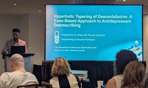Presentation about hyperbolic tapering by Shawn Gill